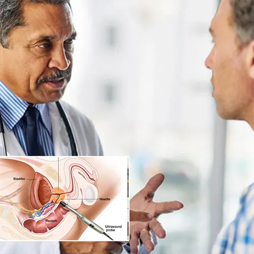 The Process: Step by Step Guide to Penile Injection Therapy